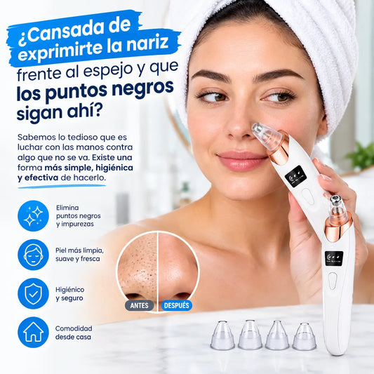 Extractor de Puntos Negros